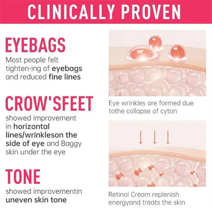 Instant Eye Bag Remove Cream Retinol Anti-Wrinkle Firming Skin Fade Fine Lines Anti Dark Circle Puffiness Brighten Eye SkinCare